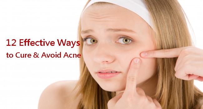 【Cure】10 Efficient Acne Vulgaris, Pimples & Zits Treatments (1-1)